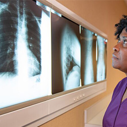 X-ray-doctor-marietta-chiropractor