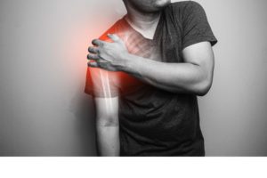 Common Causes of Shoulder Pain